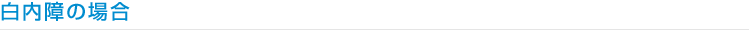 白内障の場合
