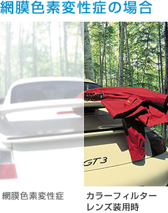 網膜色素変性症の場合