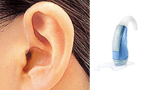 補聴器